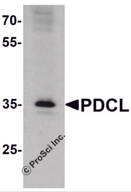 Western blot analysis of PDCL in K562 cell lysate with PDCL antibody at 1 μg/ml.