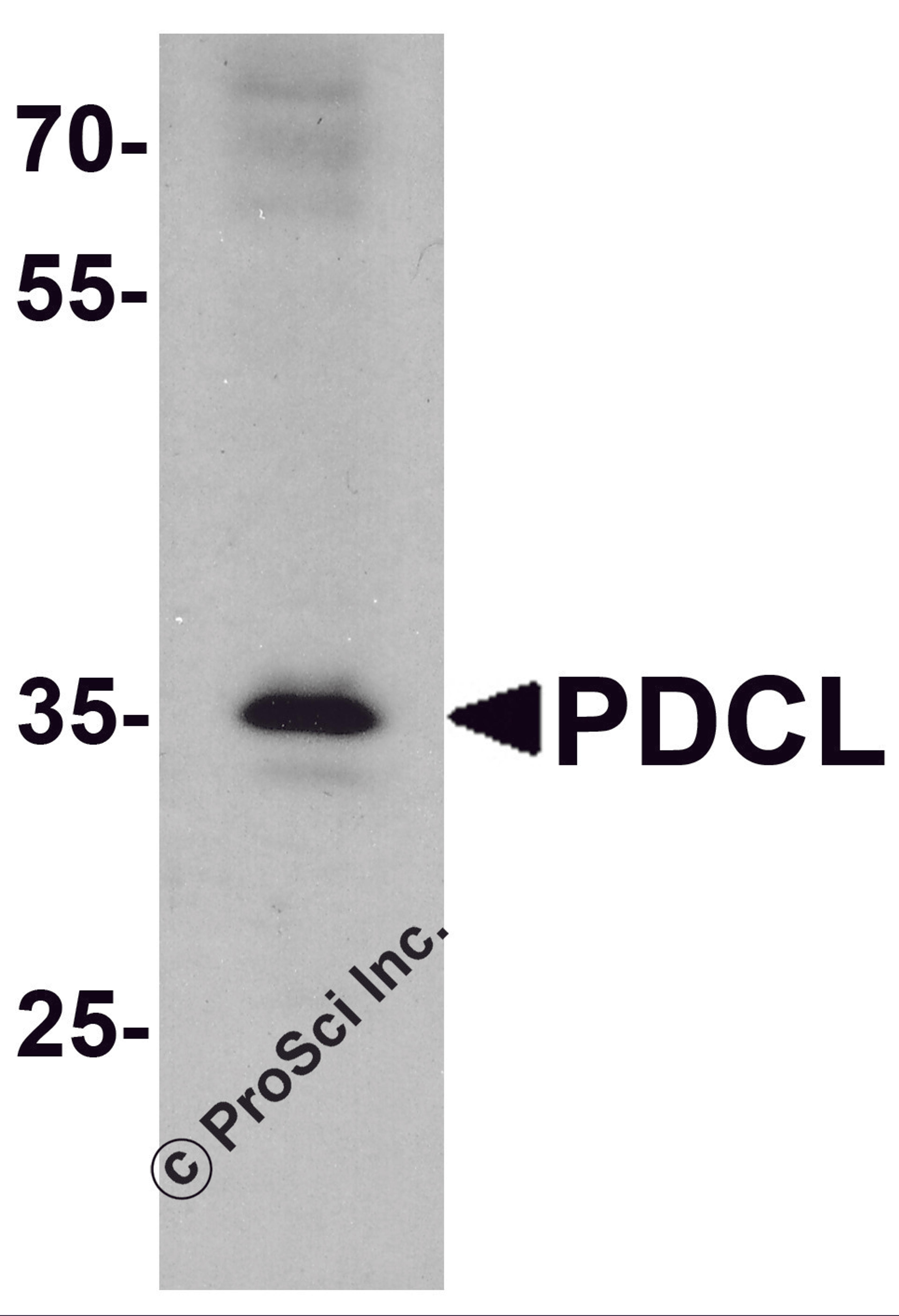 Western blot analysis of PDCL in K562 cell lysate with PDCL antibody at 1 μg/ml.