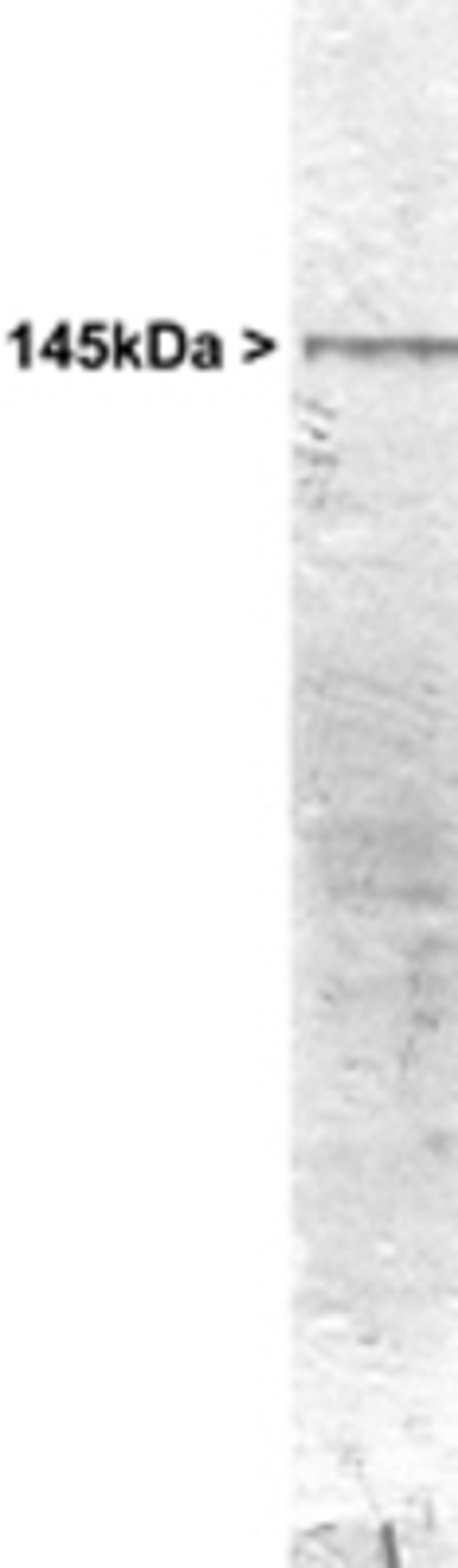 Western Blot: 160kDa Neurofilament Medium Antibody [NB300-133] - Western blot analysis of 160kDa Neurofilament Medium expression on whole rat cerebellum homogenate using NB300-133.