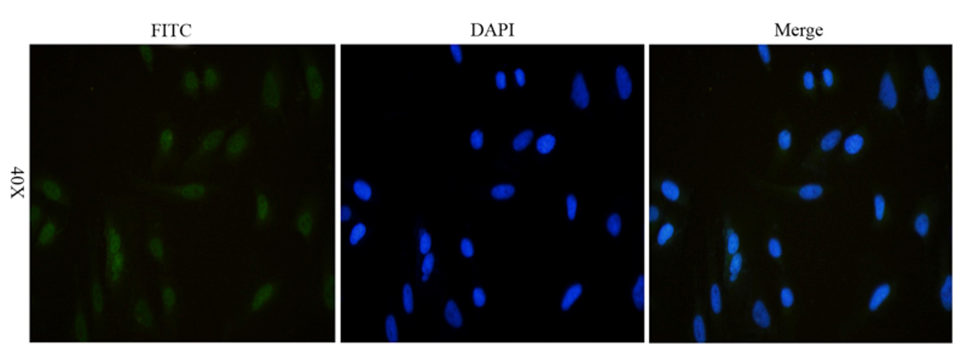 Immunofluorescence analysis of human hela cells tissue using NKp46 antibody (dilution of primary antibody - 1:100)