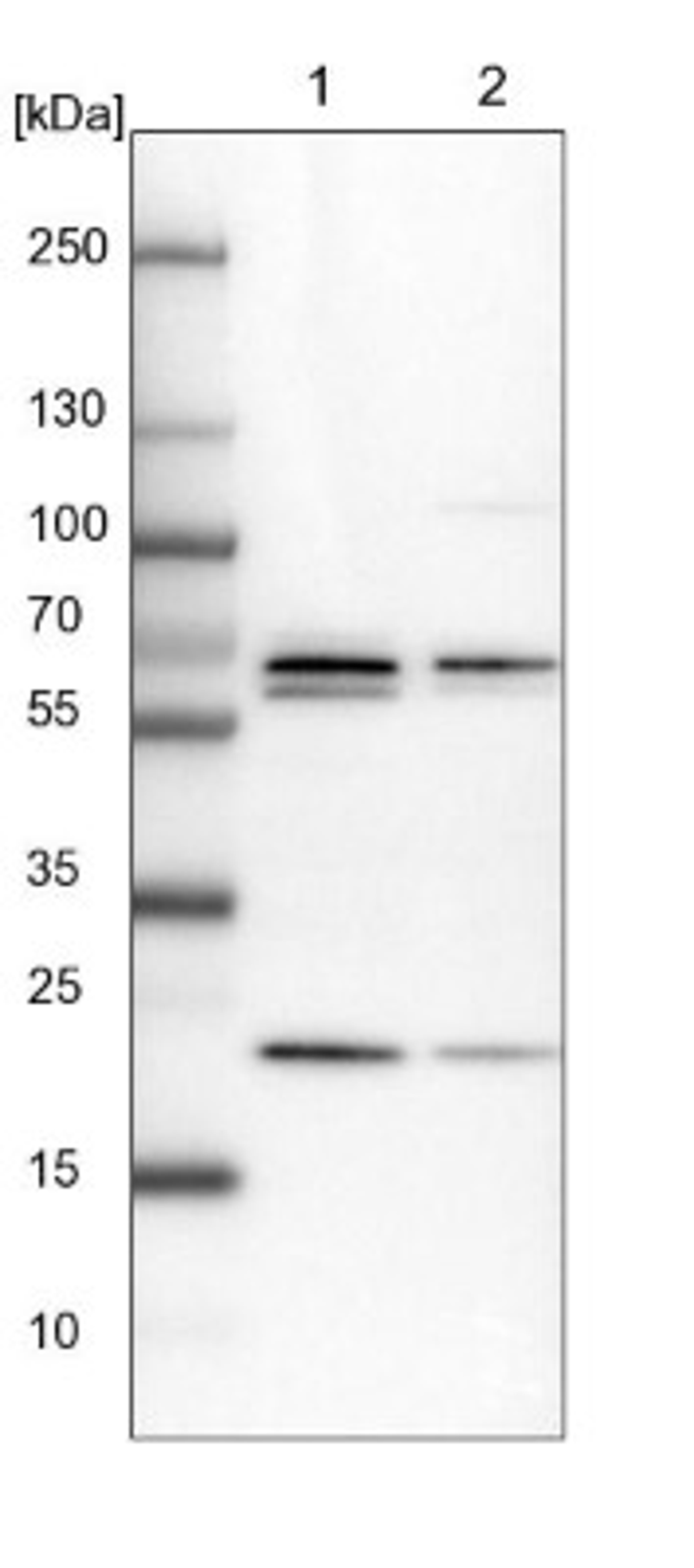 Western Blot: PSPC1 Antibody [NBP1-83801] - Lane 1: NIH-3T3 cell lysate (Mouse embryonic fibroblast cells)<br/>Lane 2: NBT-II cell lysate (Rat Wistar bladder tumour cells)