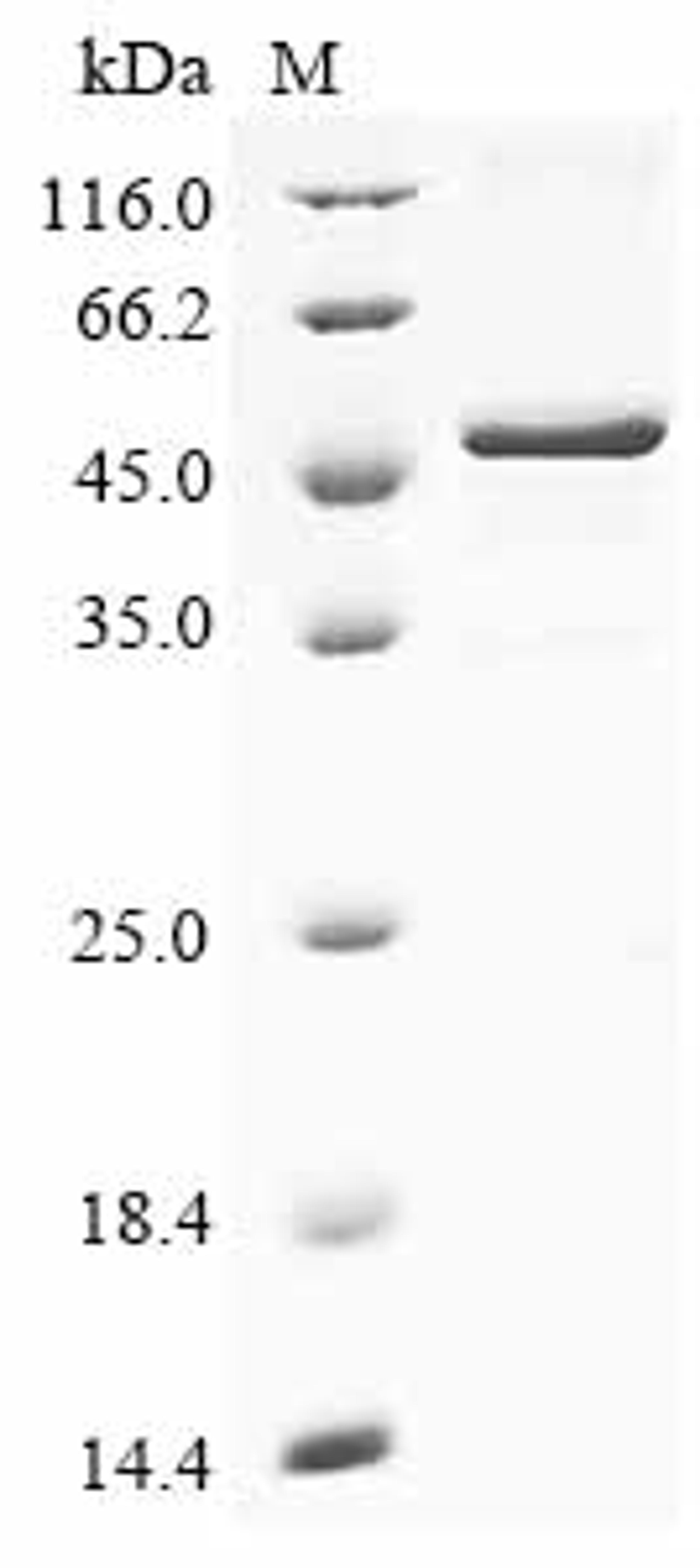 (Tris-Glycine gel) Discontinuous SDS-PAGE (reduced) with 5% enrichment gel and 15% separation gel.