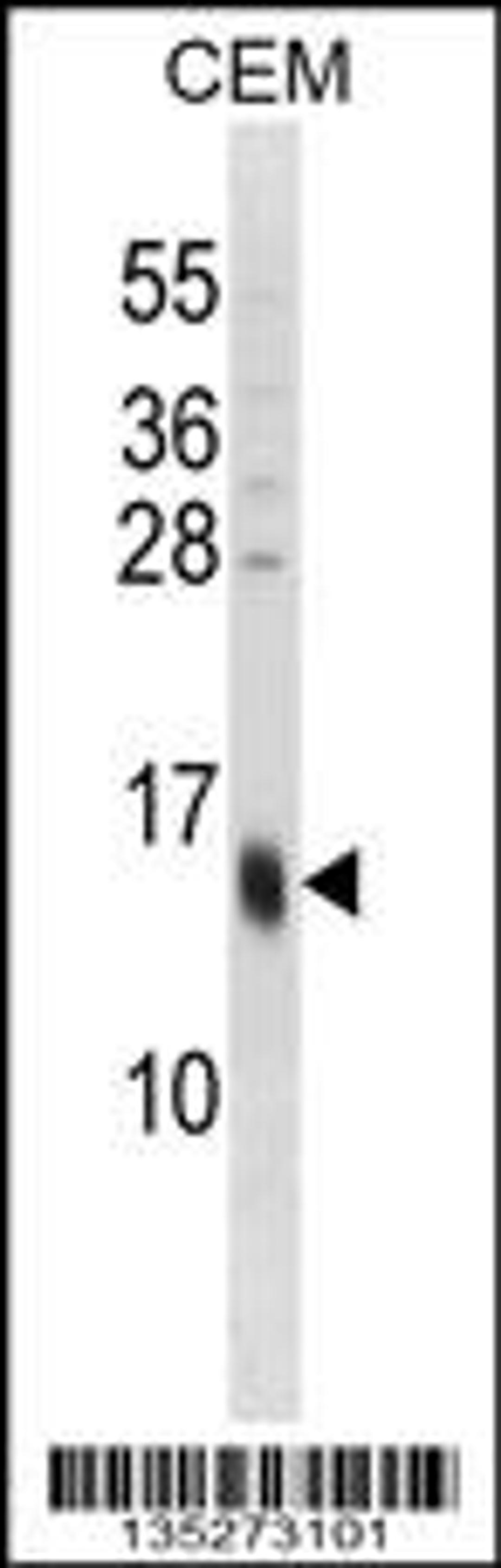 Western blot analysis in CEM cell line lysates (35ug/lane).