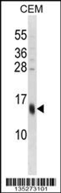 Western blot analysis in CEM cell line lysates (35ug/lane).