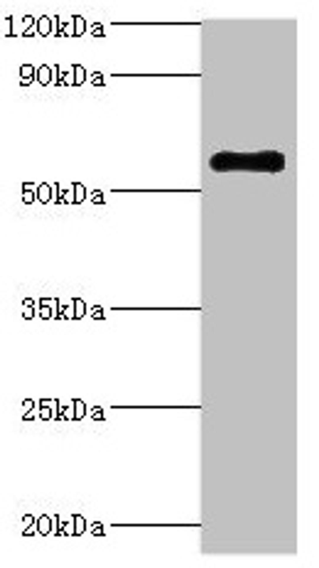 Western blot. All lanes: ATP6V1B2 antibody at 5µg/ml + Hela whole cell lysate. Secondary. Goat polyclonal to rabbit IgG at 1/10000 dilution. Predicted band size: 57 kDa. Observed band size: 57 kDa