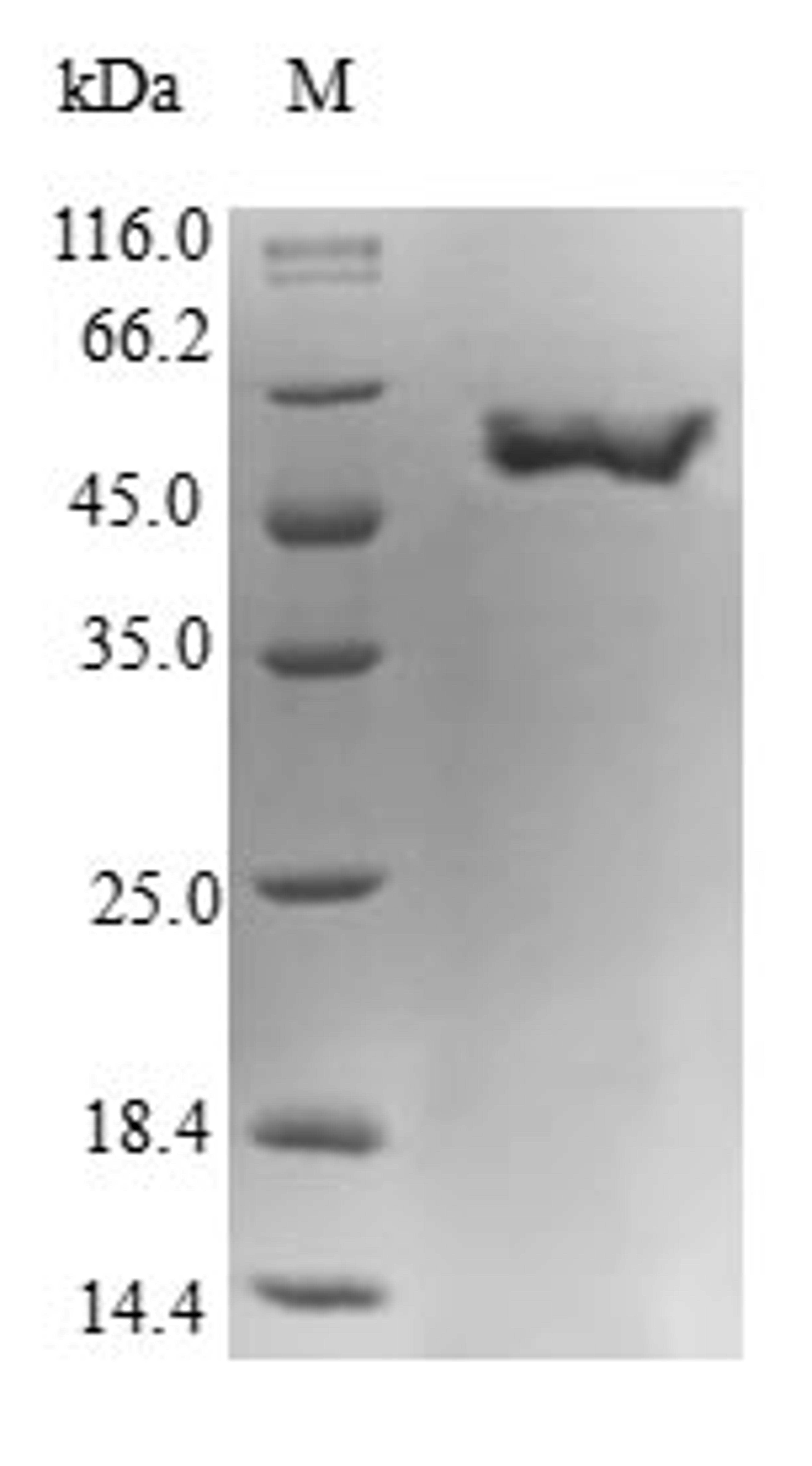 (Tris-Glycine gel) Discontinuous SDS-PAGE (reduced) with 5% enrichment gel and 15% separation gel.