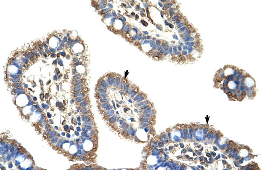 Antibody used in IHC on Human Intestine.