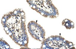 Antibody used in IHC on Human Intestine.