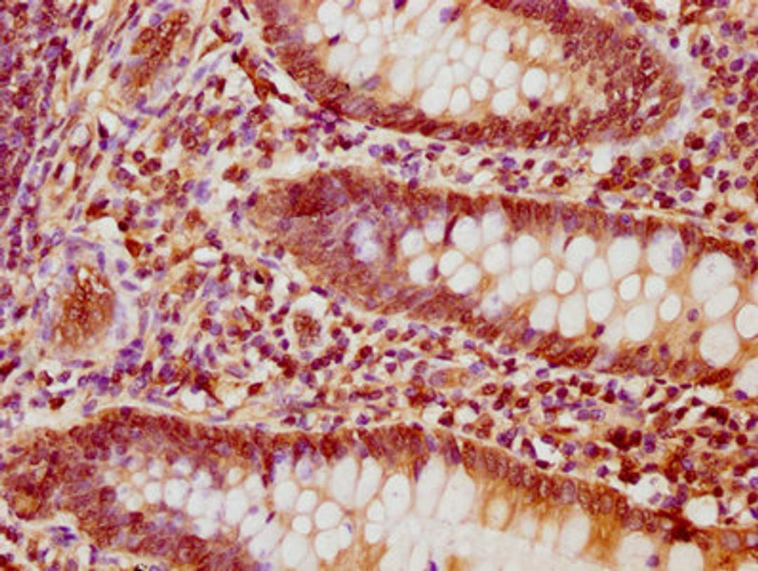 IHC image of CSB-PA17827A0Rb diluted at 1:1200 and staining in paraffin-embedded human appendix tissue performed on a Leica BondTM system. After dewaxing and hydration, antigen retrieval was mediated by high pressure in a citrate buffer (pH 6.0). Section was blocked with 10% normal goat serum 30min at RT. Then primary antibody (1% BSA) was incubated at 4&deg;C overnight. The primary is detected by a biotinylated secondary antibody and visualized using an HRP conjugated SP system.