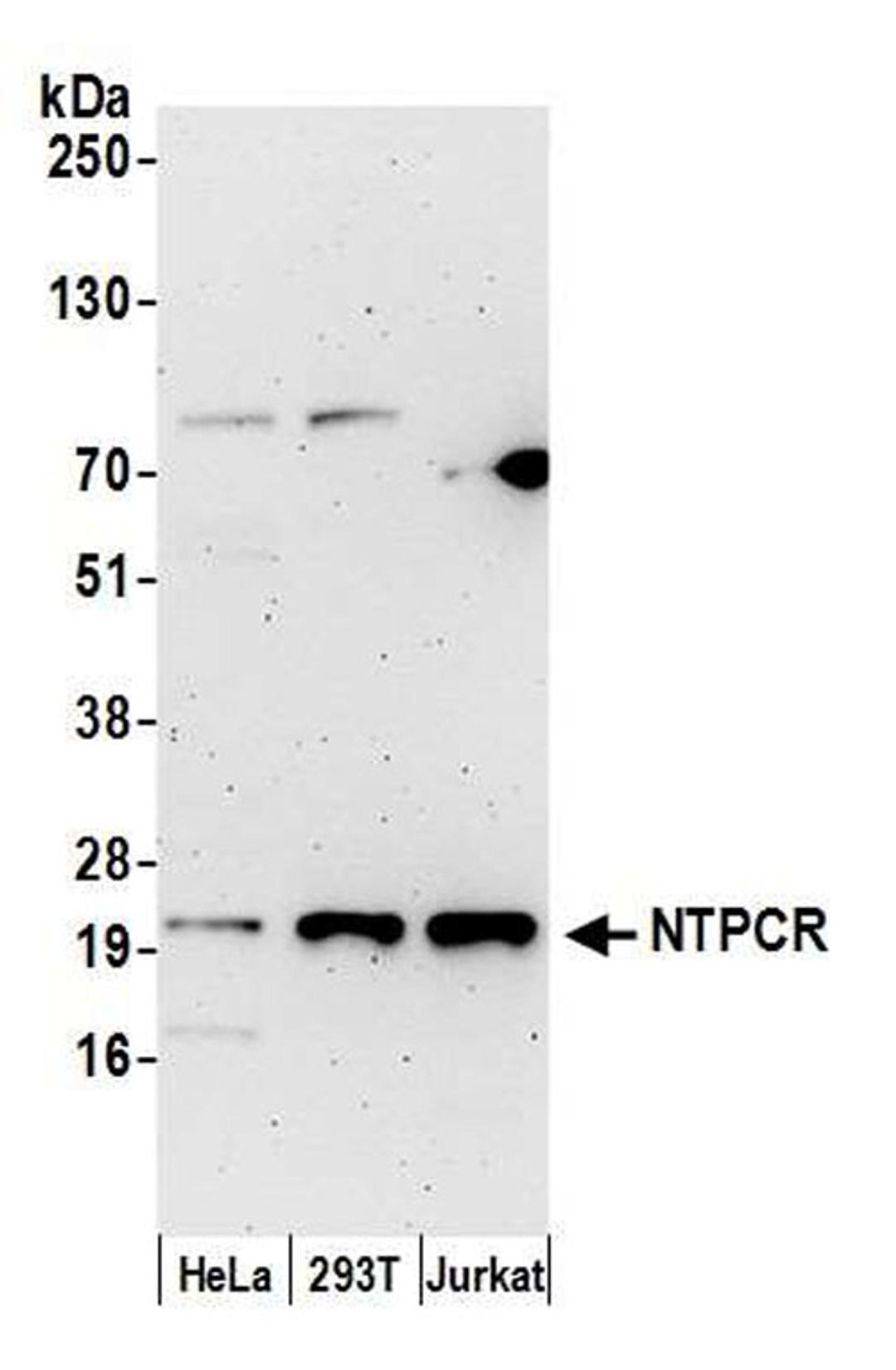 Detection of human NTPCR by WB.