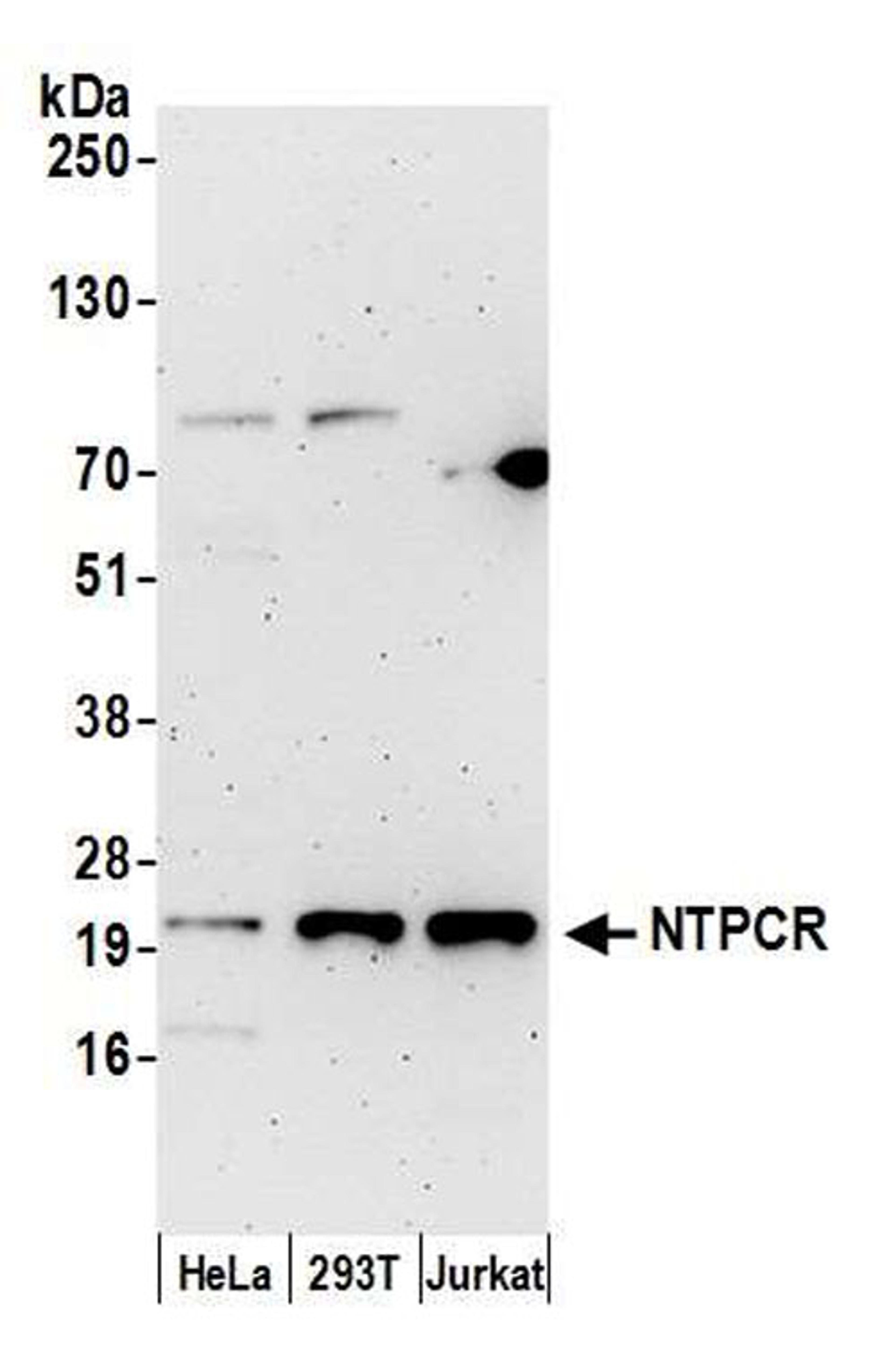 Detection of human NTPCR by WB.