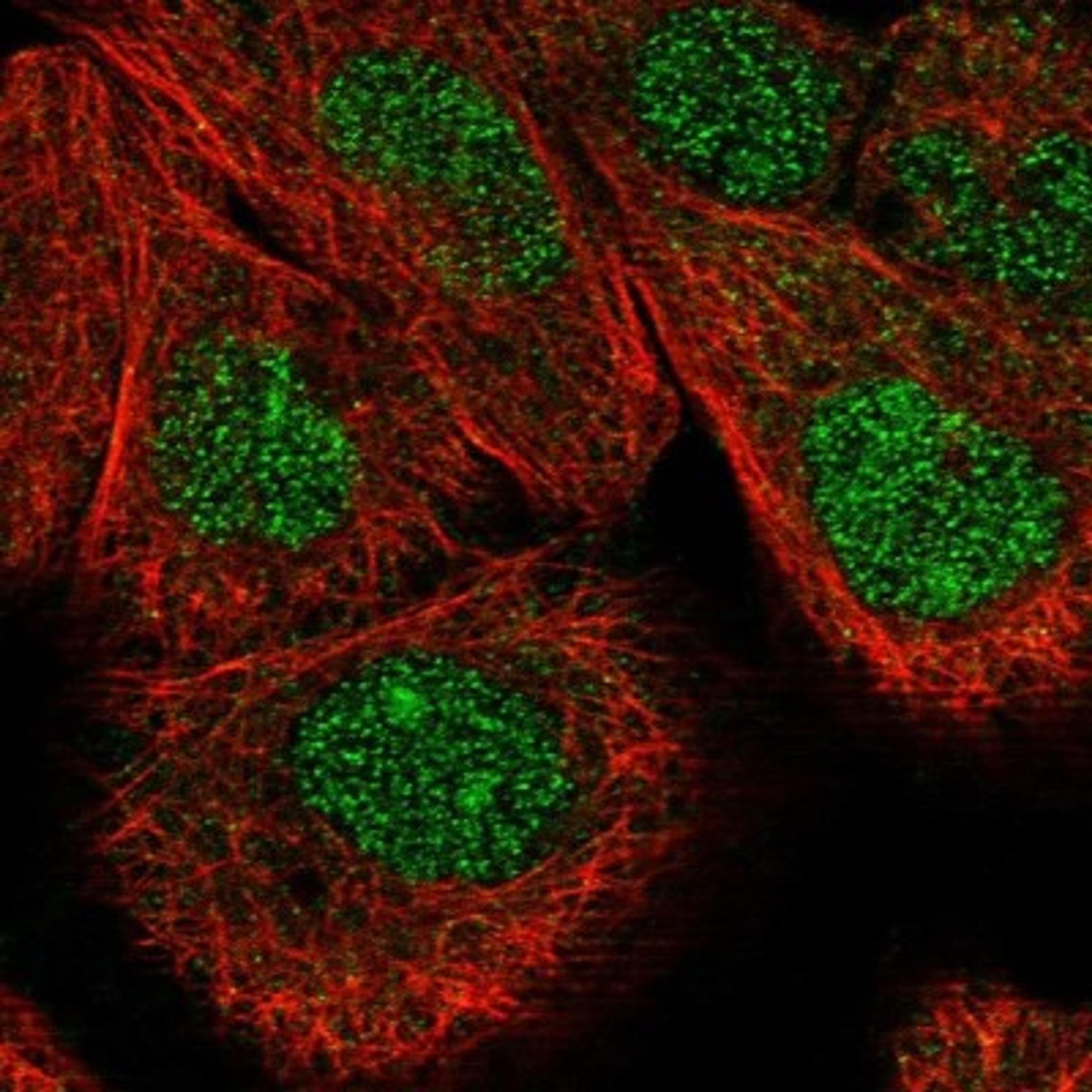 Immunocytochemistry/Immunofluorescence: SPATA17 Antibody [NBP1-83097] - Staining of human cell line A-431 shows positivity in nucleus.