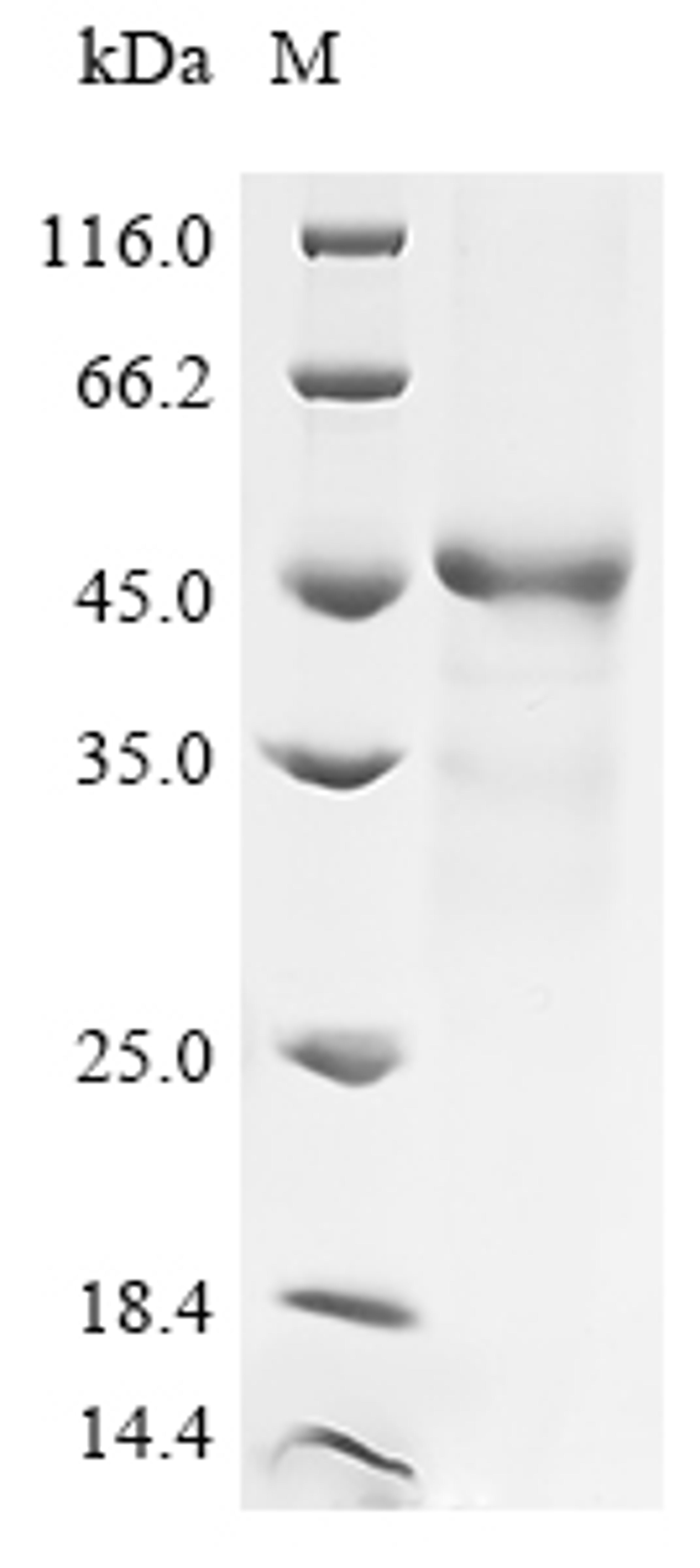 (Tris-Glycine gel) Discontinuous SDS-PAGE (reduced) with 5% enrichment gel and 15% separation gel.