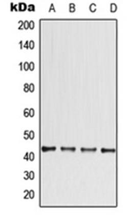 Western blot analysis of ACHN (Lane 1), HeLa (Lane 2), SP2/0 (Lane 3), PC12 (Lane 4) whole cell lysates using CCBE1 antibody