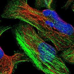 Immunocytochemistry/Immunofluorescence: CNNM4 Antibody [NBP1-89280] - Staining of human cell line U-2 OS shows positivity in cytoskeleton (actin filaments).