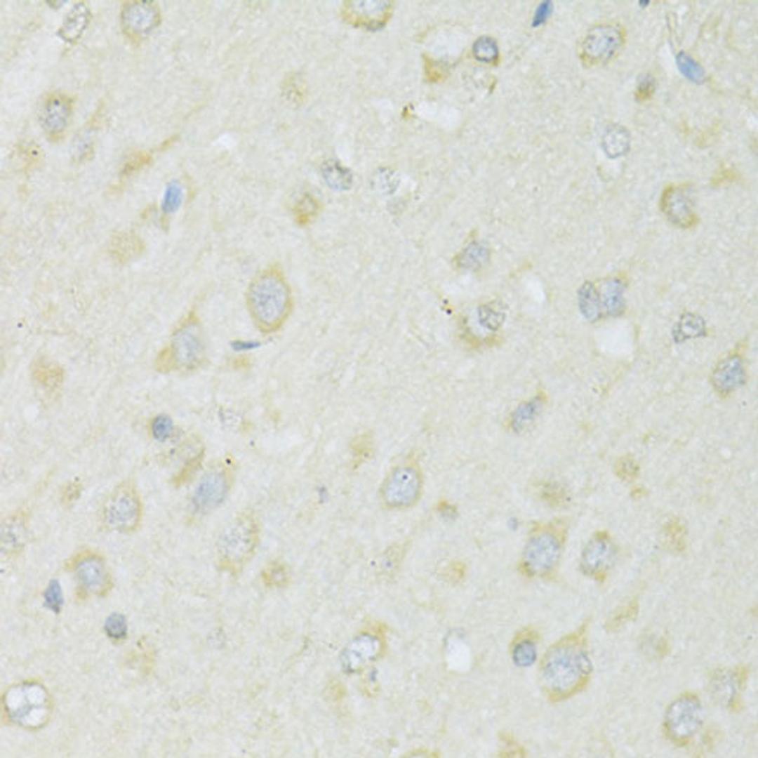 Immunohistochemistry  - SLC22A5 antibody (A14785)