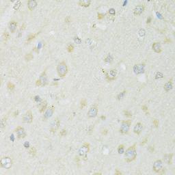 Immunohistochemistry  - SLC22A5 antibody (A14785)