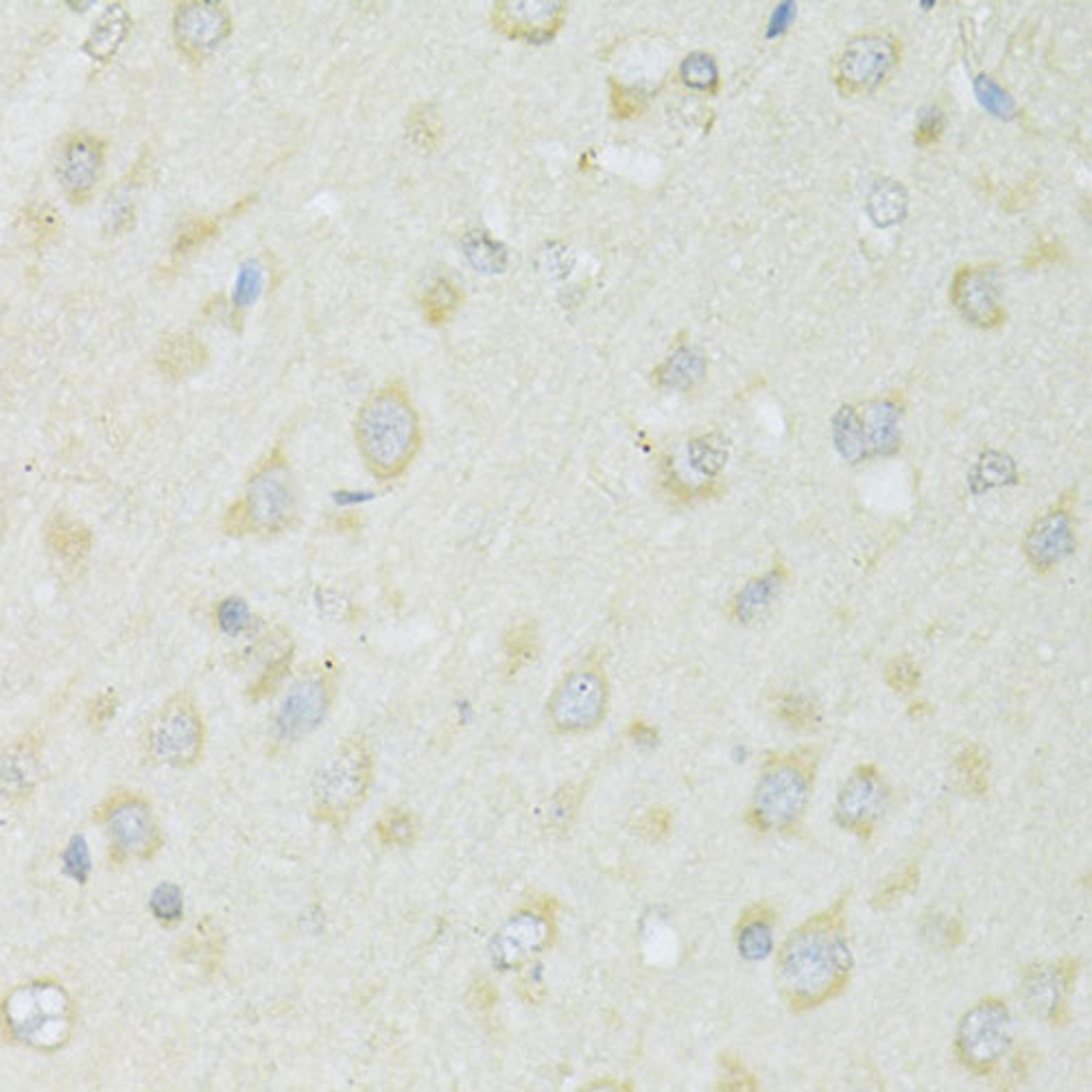 Immunohistochemistry  - SLC22A5 antibody (A14785)