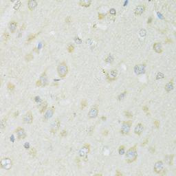 Immunohistochemistry - SLC22A5 antibody (A14785)