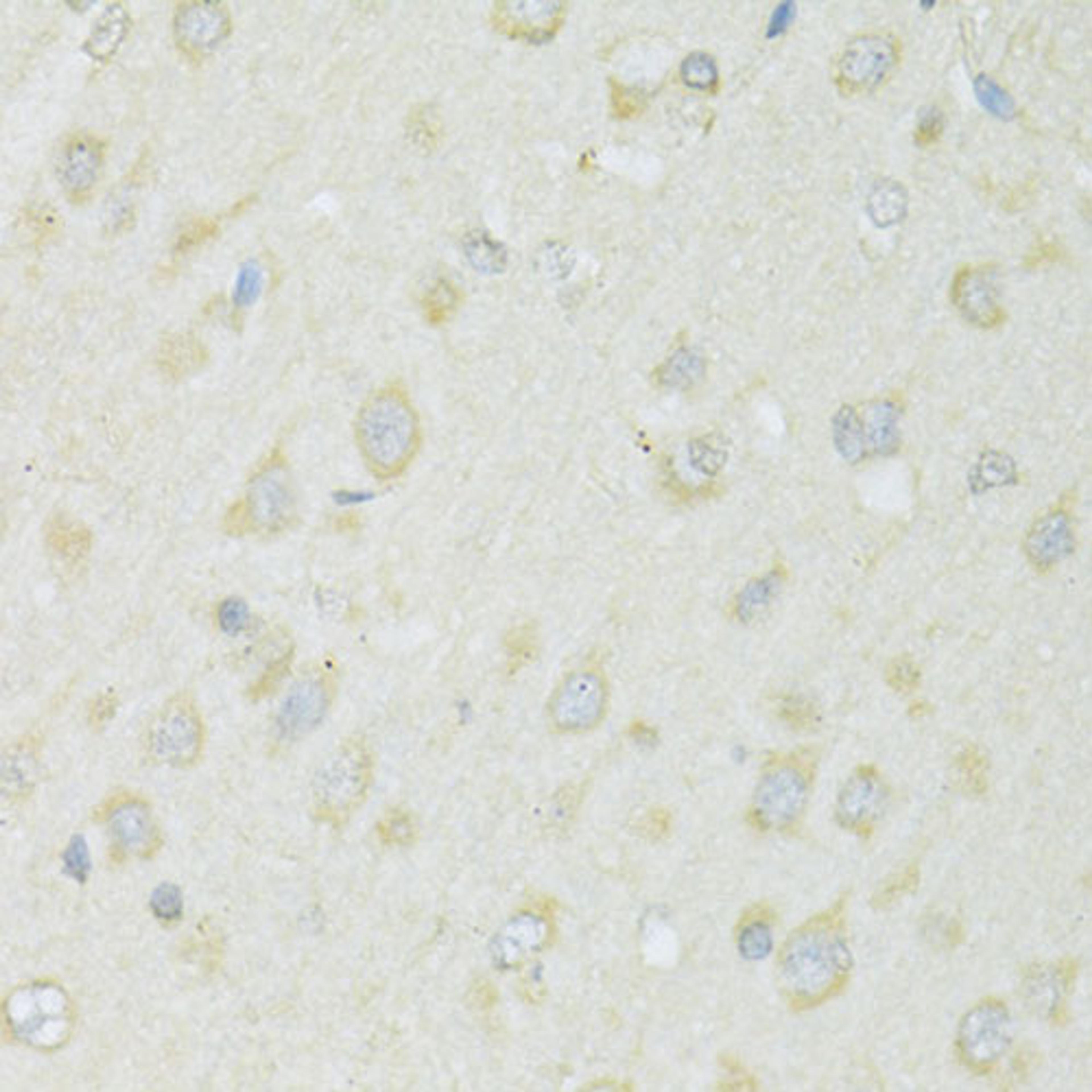 Immunohistochemistry - SLC22A5 antibody (A14785)