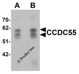 Western blot analysis of CCDC55 in human brain tissue lysate with CCDC55 antibody at (A) 0.5 and (B) 1 μg/mL