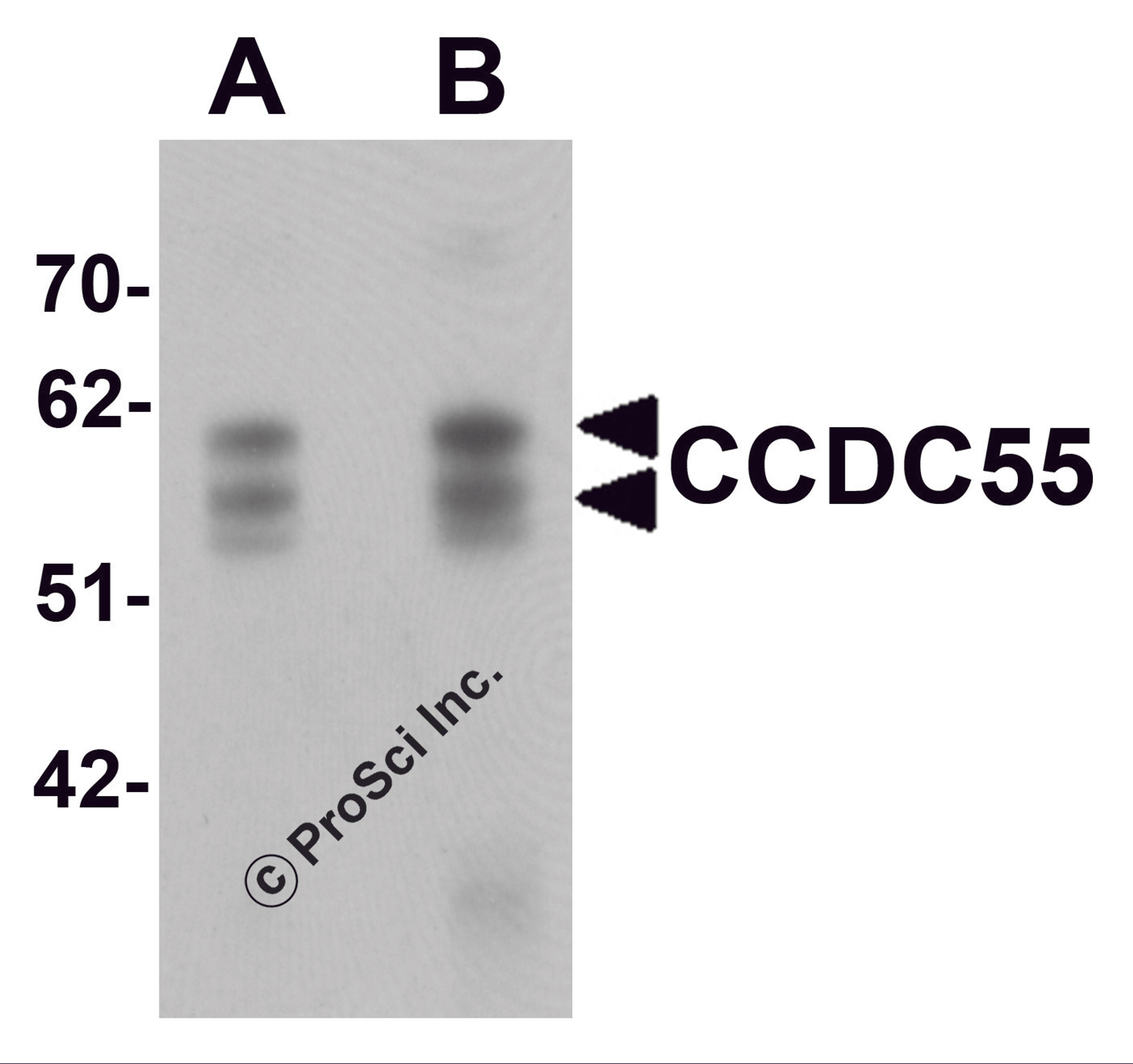 Western blot analysis of CCDC55 in human brain tissue lysate with CCDC55 antibody at (A) 0.5 and (B) 1 μg/mL