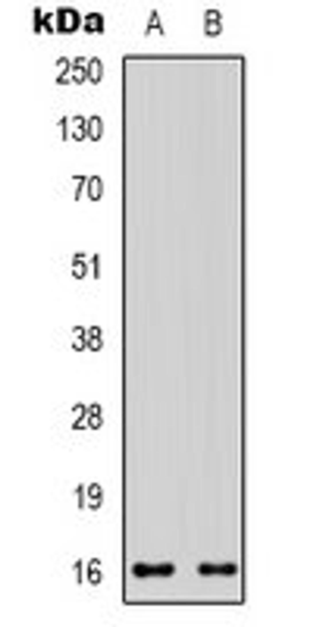 Western blot analysis of HEK293T (Lane 1), 22RV1 (Lane 2) whole cell lysates using CD235a antibody