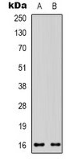 Western blot analysis of HEK293T (Lane 1), 22RV1 (Lane 2) whole cell lysates using CD235a antibody