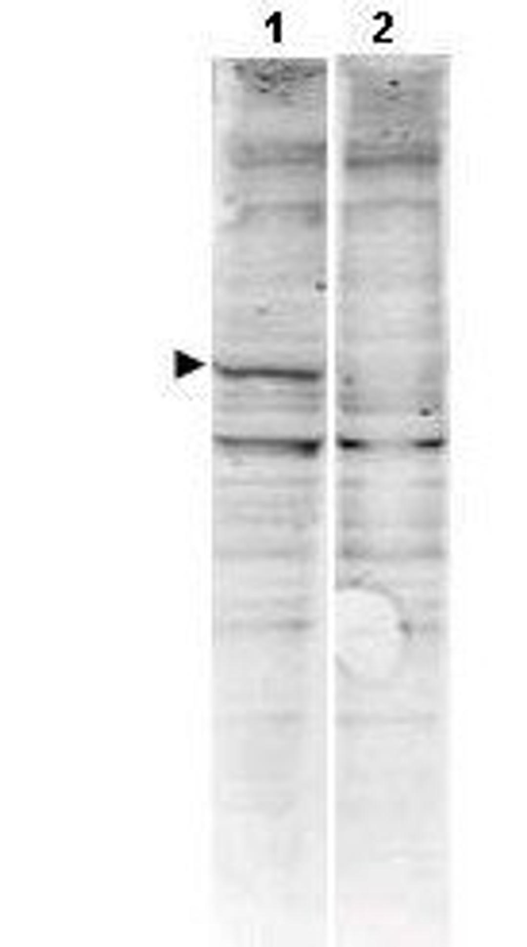 Western blot analysis of human alpha CaM Kinase II using CaM Kinase II antibody