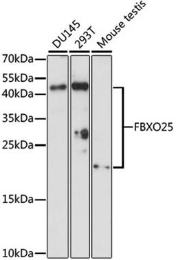 Western blot - FBXO25 antibody (A15150)