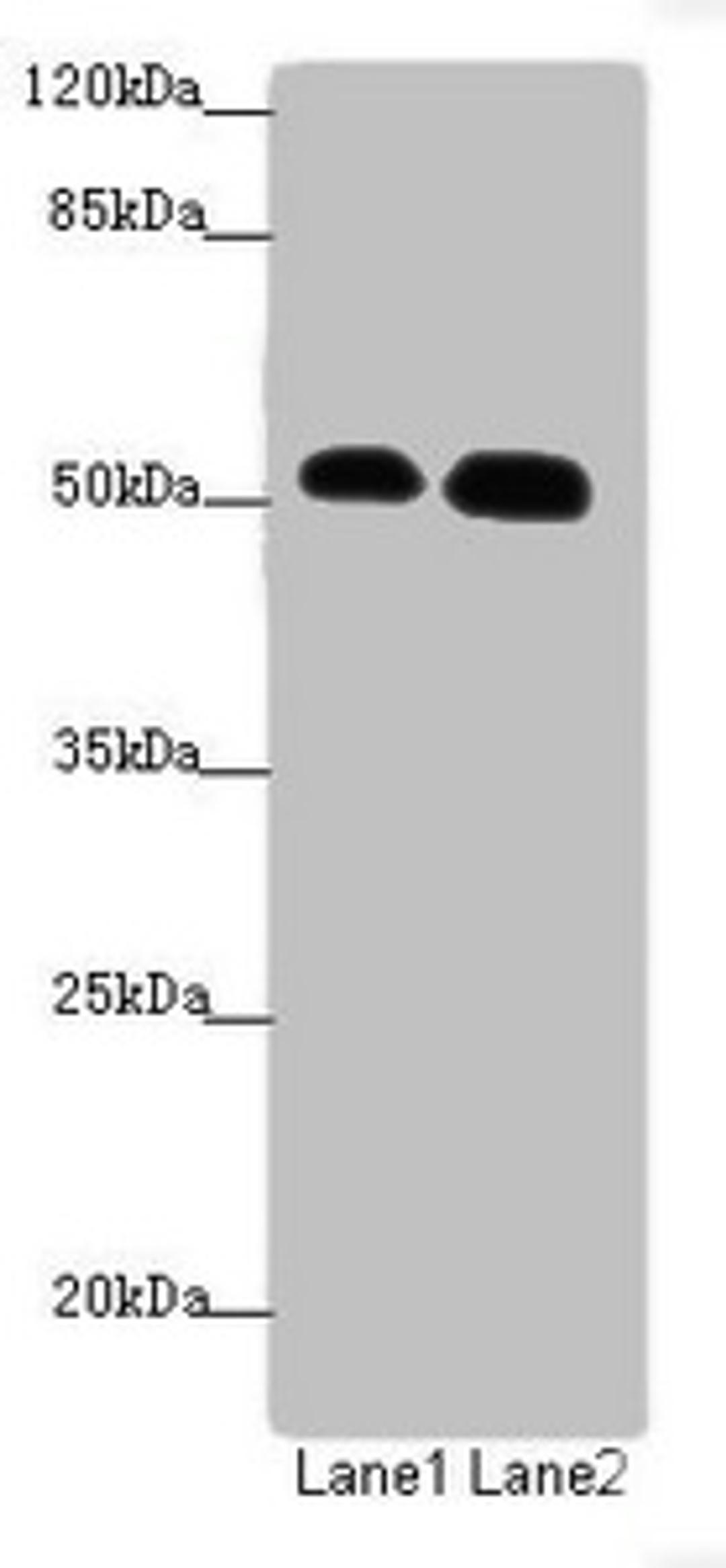 Western blot. All lanes: ATMIN antibody at 1.53ug/ml. Lane 1: Hela whole cell lysate. Lane 2: HepG2 whole cell lysate. Secondary. Goat polyclonal to rabbit IgG at 1/10000 dilution. Predicted band size: 89, 73 kDa. Observed band size: 89, 51 kDa.