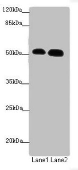 Western blot. All lanes: ATMIN antibody at 1.53ug/ml. Lane 1: Hela whole cell lysate. Lane 2: HepG2 whole cell lysate. Secondary. Goat polyclonal to rabbit IgG at 1/10000 dilution. Predicted band size: 89, 73 kDa. Observed band size: 89, 51 kDa.