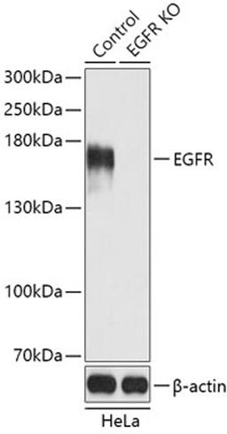 Western blot - EGFR antibody (A11576)