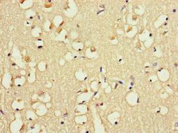 Immunohistochemistry of paraffin-embedded human brain tissue using CSB-PA007956LA01HU at dilution of 1:100
