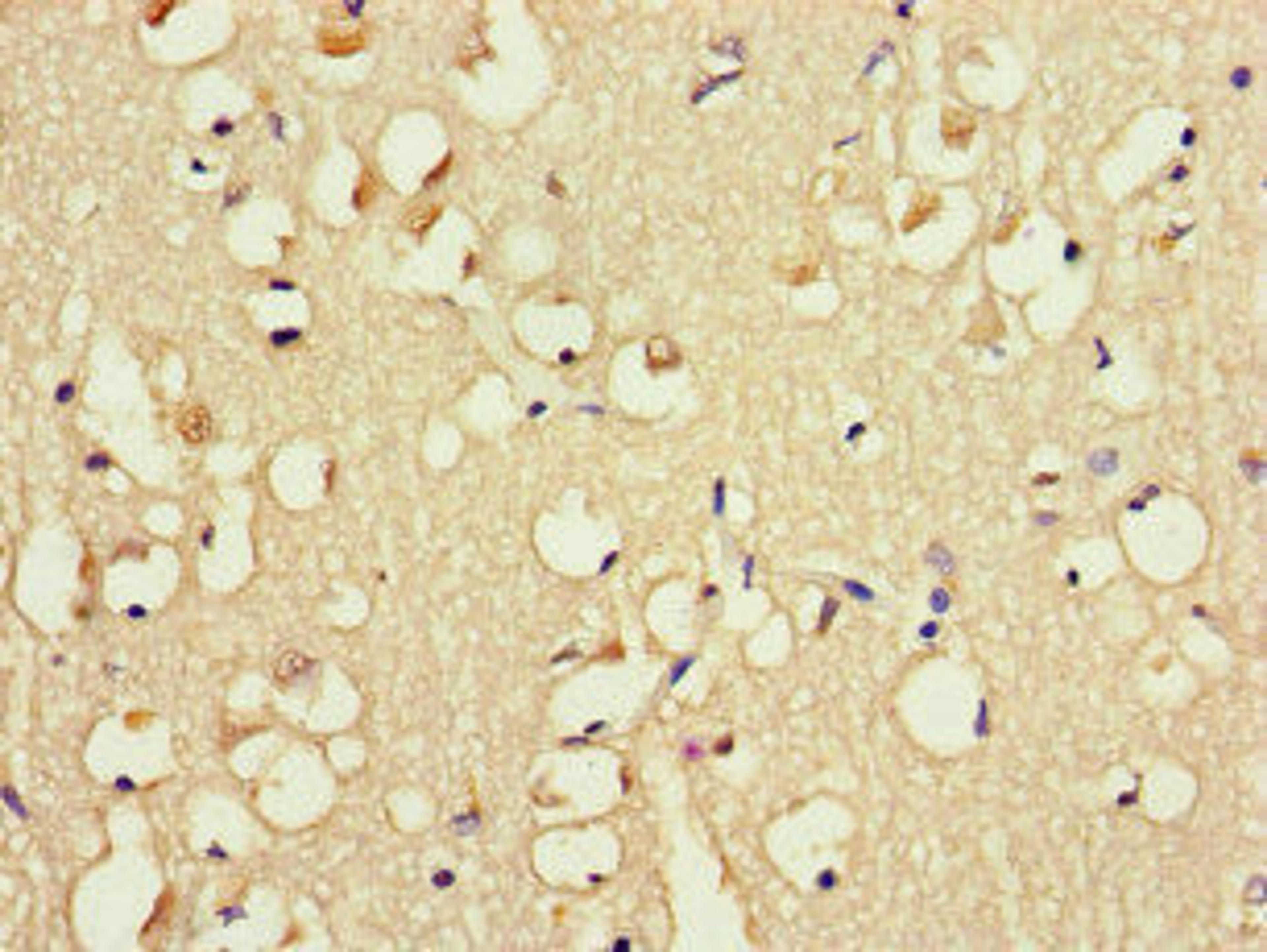 Immunohistochemistry of paraffin-embedded human brain tissue using CSB-PA007956LA01HU at dilution of 1:100