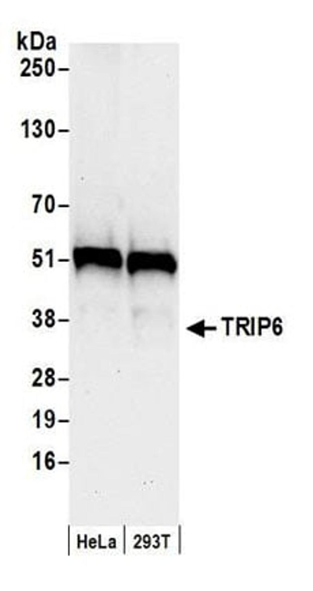 Detection of human TRIP6 by western blot.