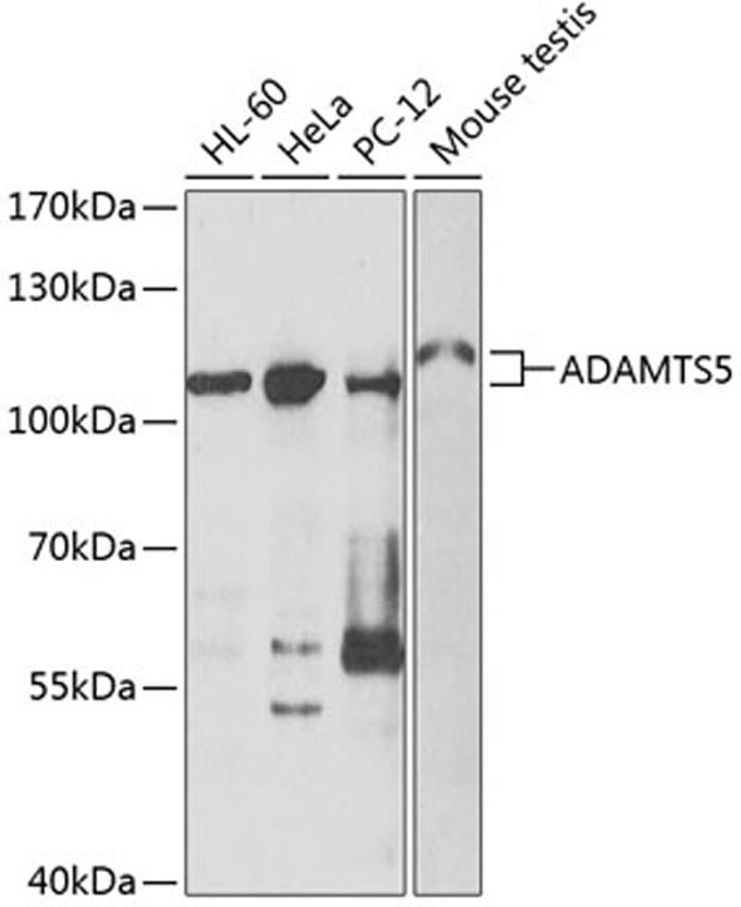 Western blot - ADAMTS5 antibody (A2836)