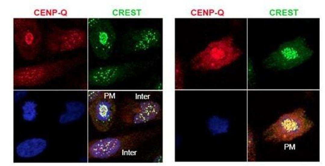 Immunofluorescence analysis of HeLa whole cell lysate using CENP-Q antibody