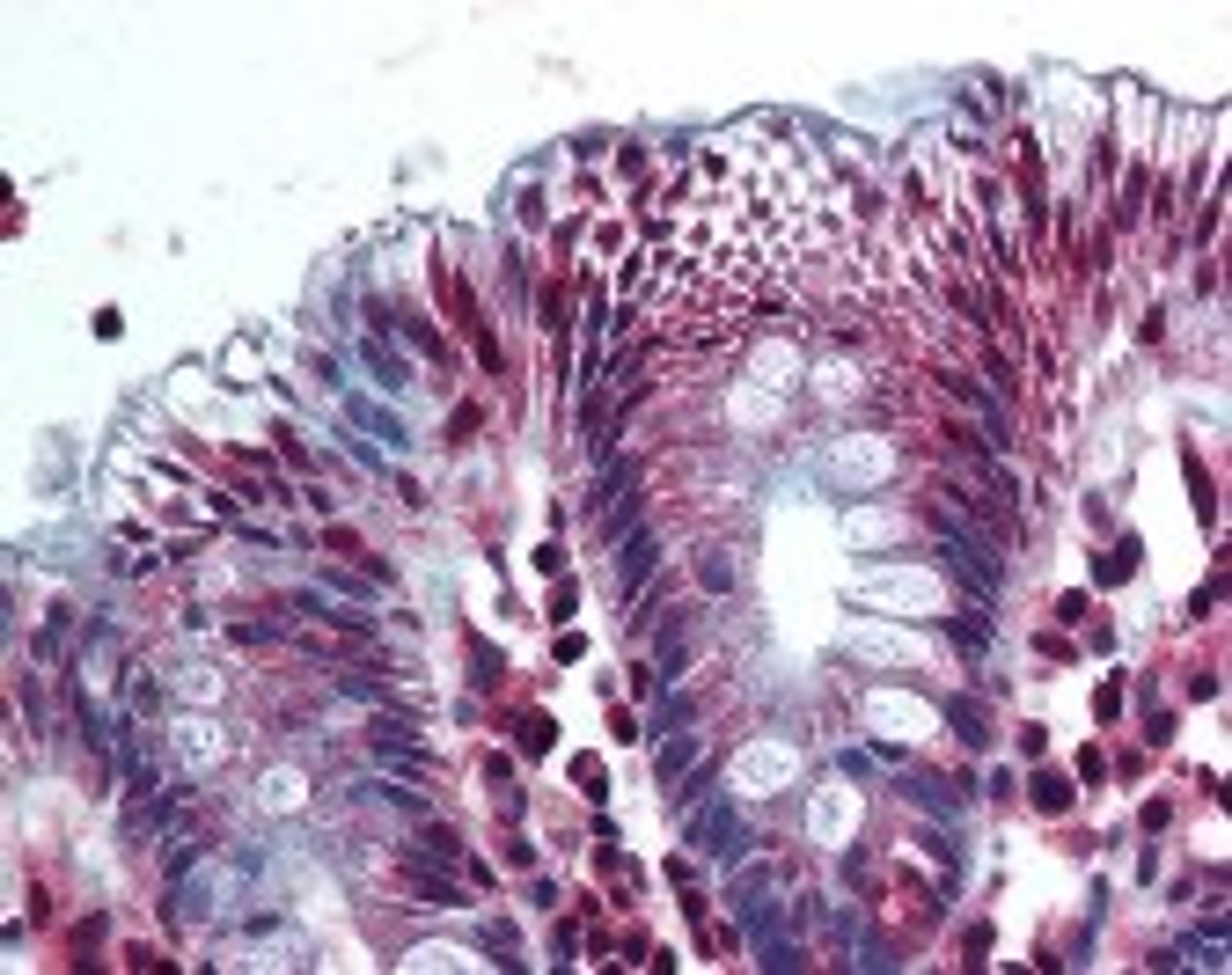 Immunohistochemistry staining of AKR1B10 in colon tissue using AKR1B10 Antibody.