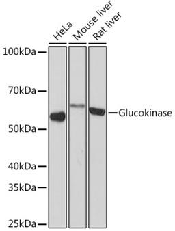 Western blot - Glucokinase Rabbit mAb (A5170)