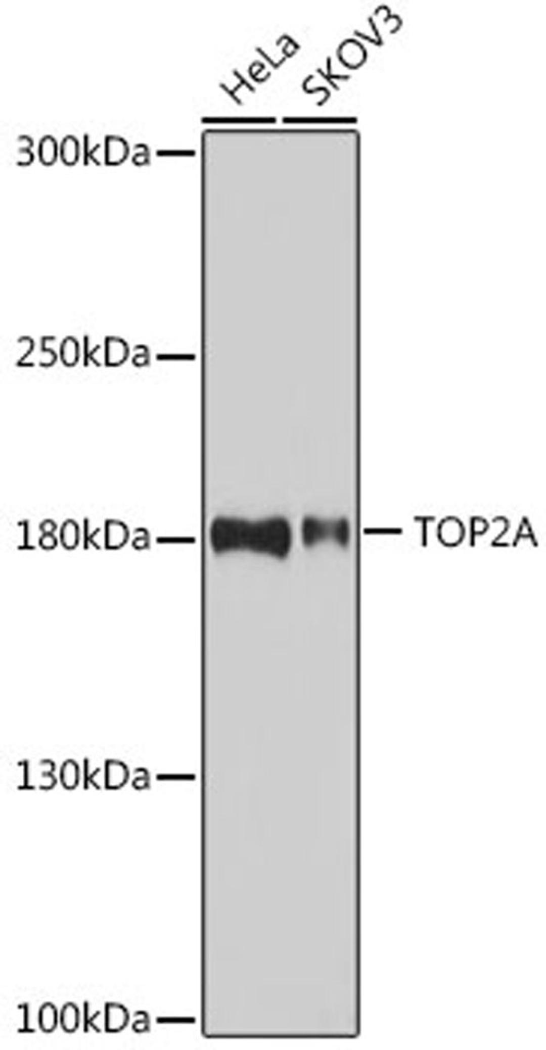 Western blot - TOP2A antibody (A16440)