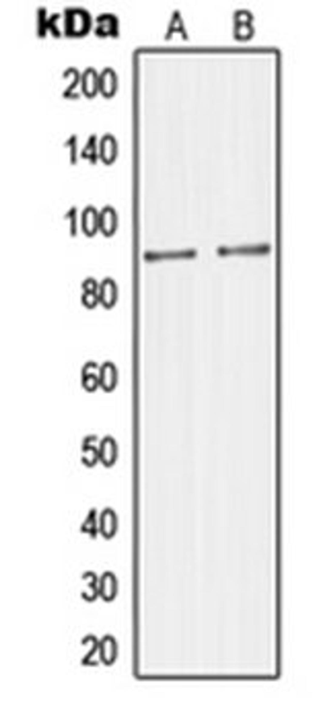 Western blot analysis of Raw264.7 (Lane 1), mouse brain (Lane 2) whole cell lysates using MAPK8IP2 antibody