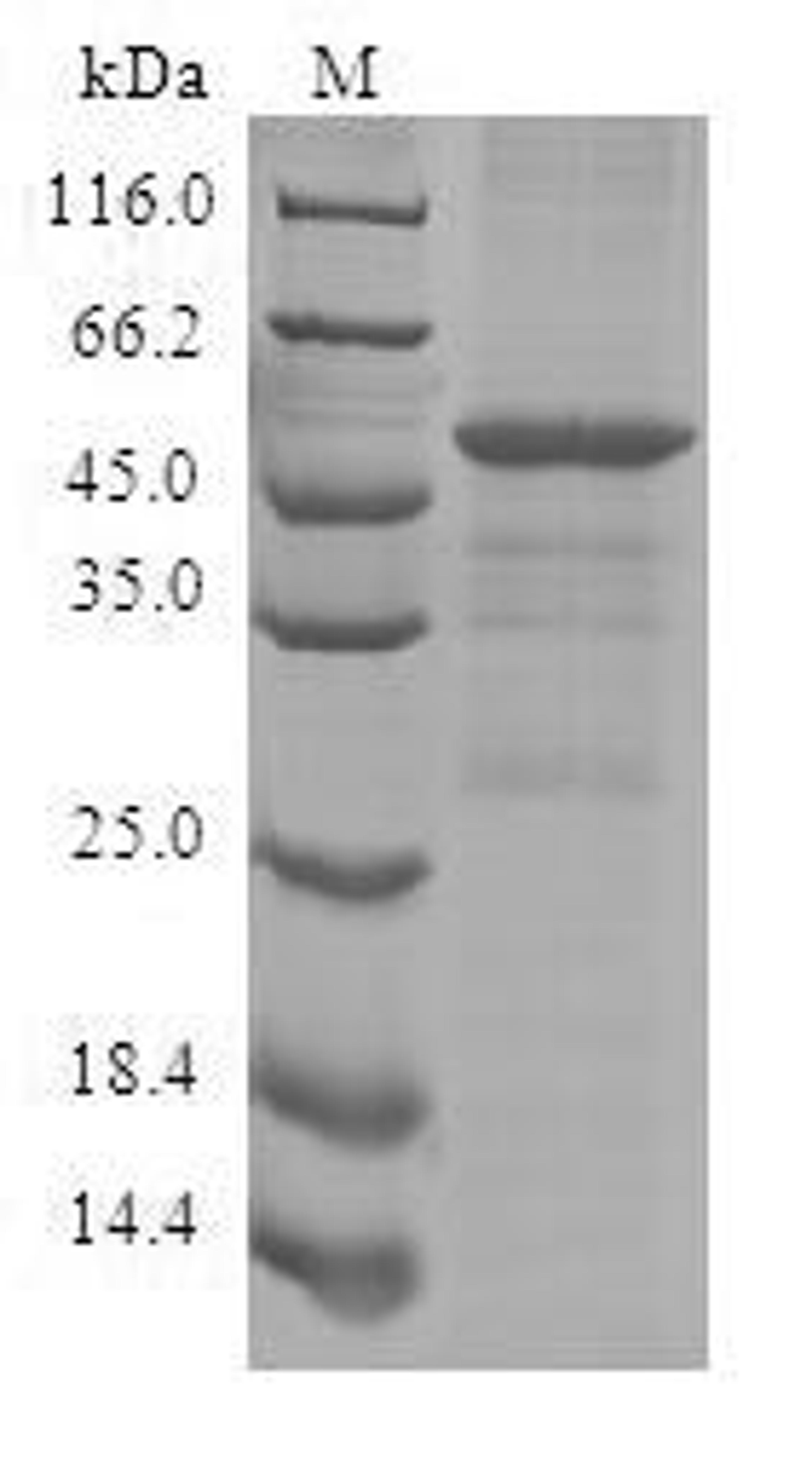 (Tris-Glycine gel) Discontinuous SDS-PAGE (reduced) with 5% enrichment gel and 15% separation gel.