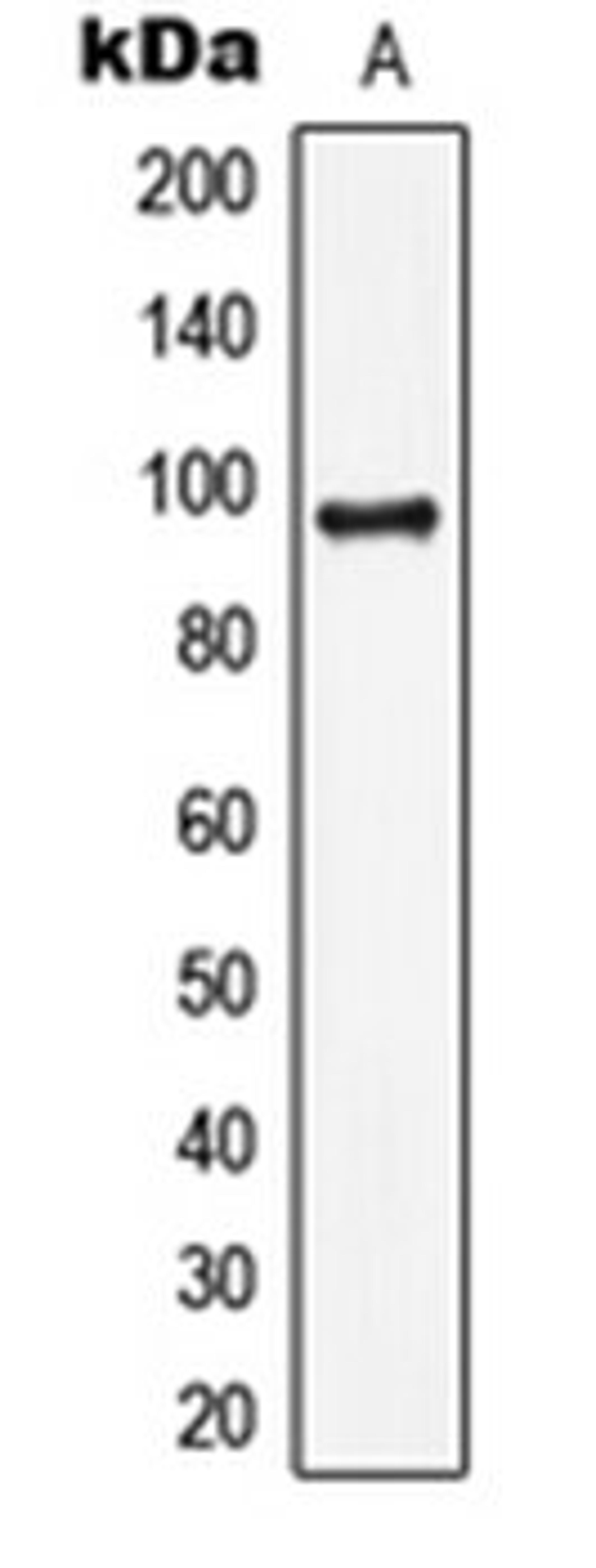 Western blot analysis of HepG2 (Lane 1) whole cell lysates using LIG4 antibody