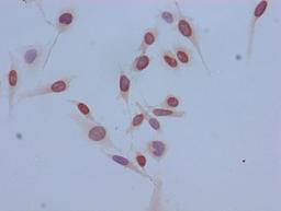 Immunocytochemistry analysis of Hela cells using CSB-PA010418OA14acHU at dilution of 1:100
