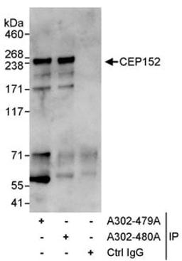 Detection of human CEP152 by western blot of immunoprecipitates.