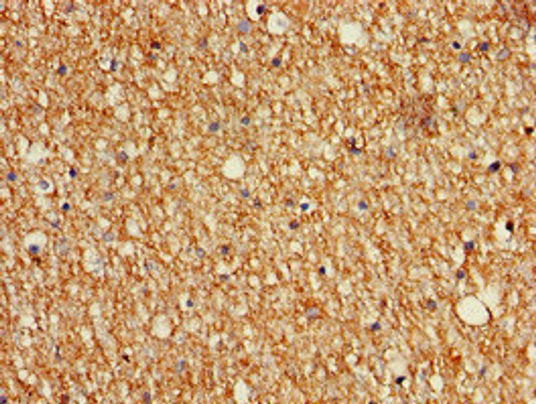 Immunohistochemistry of paraffin-embedded human brain tissue using CSB-PA013450LA01HU at dilution of 1:100