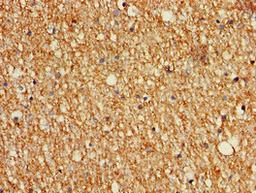 Immunohistochemistry of paraffin-embedded human brain tissue using CSB-PA013450LA01HU at dilution of 1:100