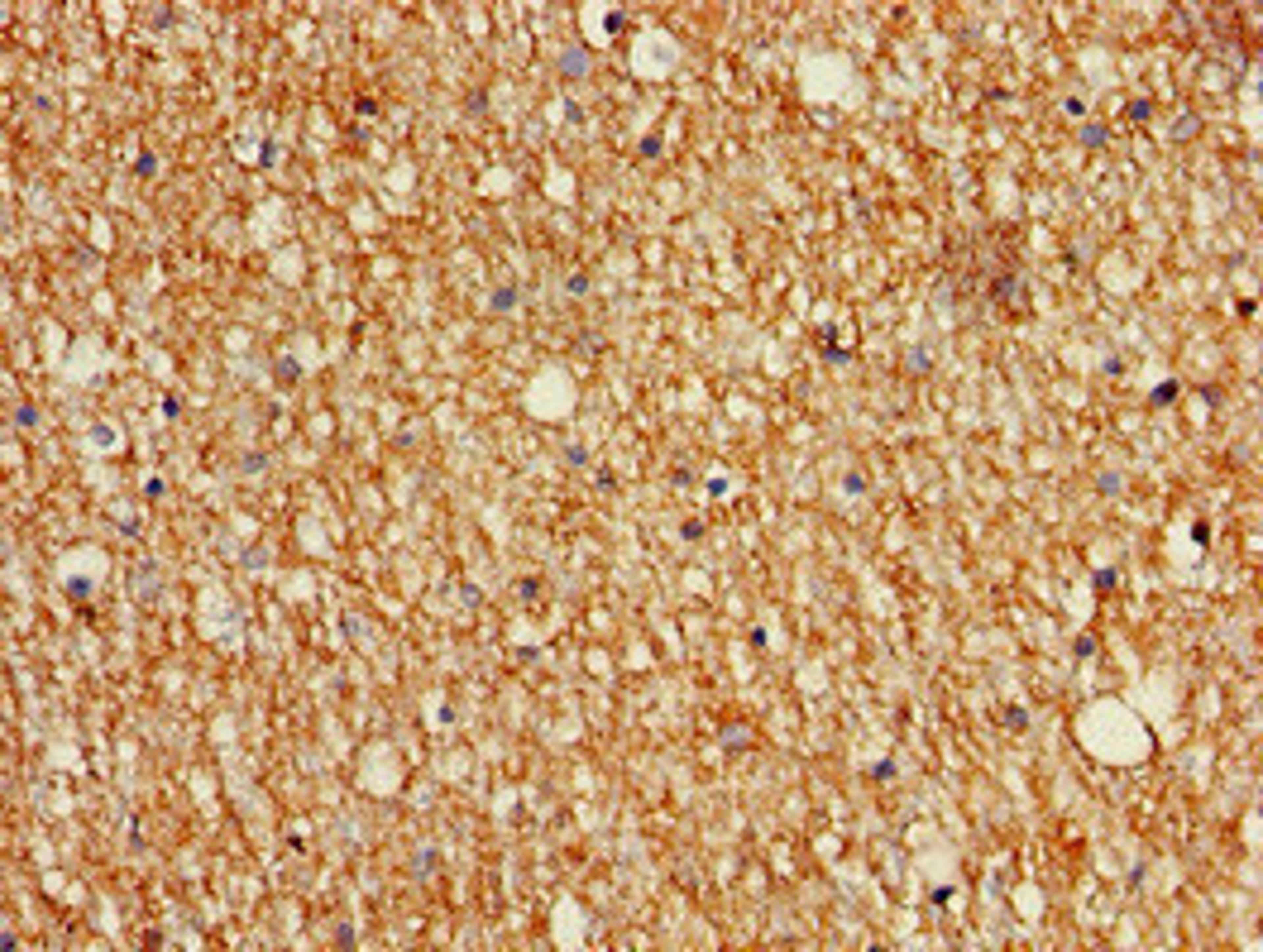 Immunohistochemistry of paraffin-embedded human brain tissue using CSB-PA013450LA01HU at dilution of 1:100
