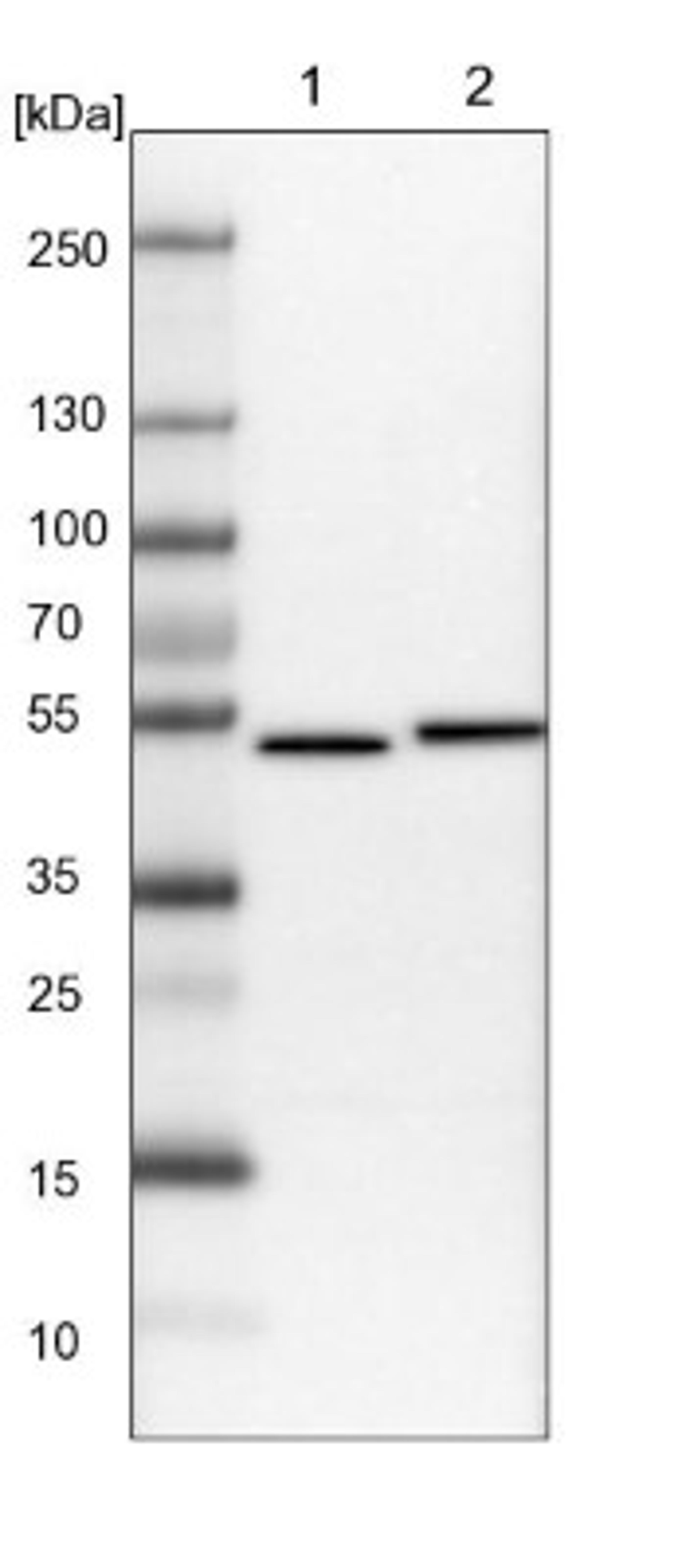 Western Blot: USH1G Antibody [NBP1-89076] - Lane 1: NIH-3T3 cell lysate (Mouse embryonic fibroblast cells)<br/>Lane 2: NBT-II cell lysate (Rat Wistar bladder tumour cells)